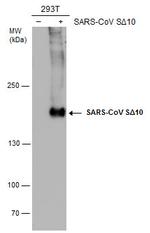 SARS/SARS-CoV-2 Spike Protein S2 Antibody in Western Blot (WB)