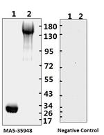 SARS-CoV-2 Spike Protein (S1/S2) Antibody in Western Blot (WB)
