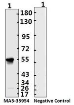 SARS-CoV-2 Nucleocapsid Antibody in Western Blot (WB)