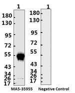 SARS-CoV-2 Nucleocapsid Antibody in Western Blot (WB)