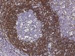 Bcl-2 Antibody in Immunohistochemistry (Paraffin) (IHC (P))