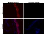 Cytokeratin 14 Antibody in Immunohistochemistry (Paraffin) (IHC (P))