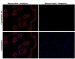 Cytokeratin 14 Antibody in Immunohistochemistry (Paraffin) (IHC (P))