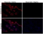 Cytokeratin 14 Antibody