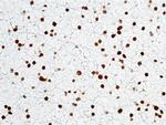 OLIG2 Antibody in Immunohistochemistry (Paraffin) (IHC (P))