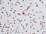 OLIG2 Antibody in Immunohistochemistry (Paraffin) (IHC (P))