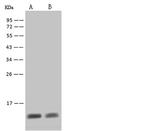 S100A8 Antibody in Western Blot (WB)