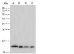 beta-2 Microglobulin Antibody in Western Blot (WB)