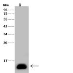 FABP1 Antibody in Western Blot (WB)