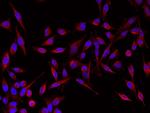 GIF Antibody in Immunocytochemistry (ICC/IF)