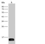 Zika Virus Envelope (Domain III) (strain Zika SPH2015) Antibody in Western Blot (WB)