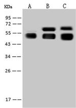 Angiotensinogen Antibody in Western Blot (WB)