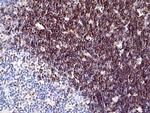 CD1a Antibody in Immunohistochemistry (Paraffin) (IHC (P))