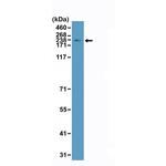 TOP2A Antibody in Western Blot (WB)