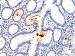 Helicobacter pylori Antibody in Immunohistochemistry (Paraffin) (IHC (P))