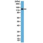 MSH3 Antibody in Western Blot (WB)