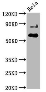 Phospho-AKT1 (Thr450) Antibody in Western Blot (WB)