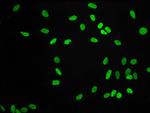 H3K9me2 Antibody in Immunocytochemistry (ICC/IF)