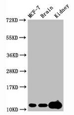 H4K20me3 Antibody in Western Blot (WB)