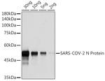 SARS-CoV-2 Nucleocapsid Antibody in Western Blot (WB)