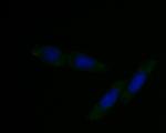 DFNA5 Antibody in Immunocytochemistry (ICC/IF)