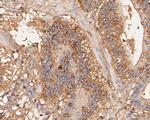 Aspartate Aminotransferase, Cytoplasmic Antibody in Immunohistochemistry (Paraffin) (IHC (P))