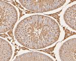 Aspartate Aminotransferase, Cytoplasmic Antibody in Immunohistochemistry (Paraffin) (IHC (P))