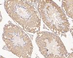 RUVBL2 Antibody in Immunohistochemistry (Paraffin) (IHC (P))