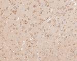 LYRIC Antibody in Immunohistochemistry (Paraffin) (IHC (P))