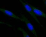 ROBO1 Antibody in Immunocytochemistry (ICC/IF)