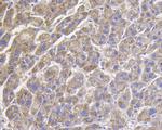 ROBO1 Antibody in Immunohistochemistry (Paraffin) (IHC (P))