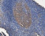 Annexin A3 Antibody in Immunohistochemistry (Paraffin) (IHC (P))