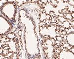 Annexin A3 Antibody in Immunohistochemistry (Paraffin) (IHC (P))