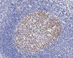 DNMT1 Antibody in Immunohistochemistry (Paraffin) (IHC (P))