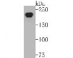 DNMT1 Antibody in Western Blot (WB)