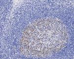 DNMT1 Antibody in Immunohistochemistry (Paraffin) (IHC (P))