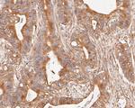 Cytokeratin 20 Antibody in Immunohistochemistry (Paraffin) (IHC (P))