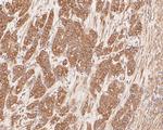 Cytokeratin 20 Antibody in Immunohistochemistry (Paraffin) (IHC (P))