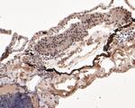 DDX24 Antibody in Immunohistochemistry (Paraffin) (IHC (P))