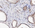 HMGB2 Antibody in Immunohistochemistry (Paraffin) (IHC (P))