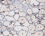 HMGB2 Antibody in Immunohistochemistry (Paraffin) (IHC (P))