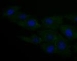 CASPR Antibody in Immunocytochemistry (ICC/IF)