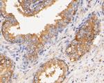 CASK Antibody in Immunohistochemistry (Paraffin) (IHC (P))