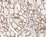 NuMA Antibody in Immunohistochemistry (Paraffin) (IHC (P))