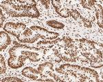 NuMA Antibody in Immunohistochemistry (Paraffin) (IHC (P))