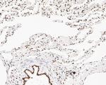 NuMA Antibody in Immunohistochemistry (Paraffin) (IHC (P))