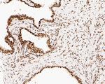 NuMA Antibody in Immunohistochemistry (Paraffin) (IHC (P))