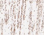 NuMA Antibody in Immunohistochemistry (Paraffin) (IHC (P))