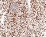 NuMA Antibody in Immunohistochemistry (Paraffin) (IHC (P))