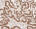 NuMA Antibody in Immunohistochemistry (Paraffin) (IHC (P))